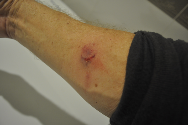 The Problem With CO2 Pressure